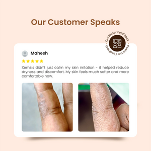 Our customer Mahesh's feedback about Xemsis before and after using our product.