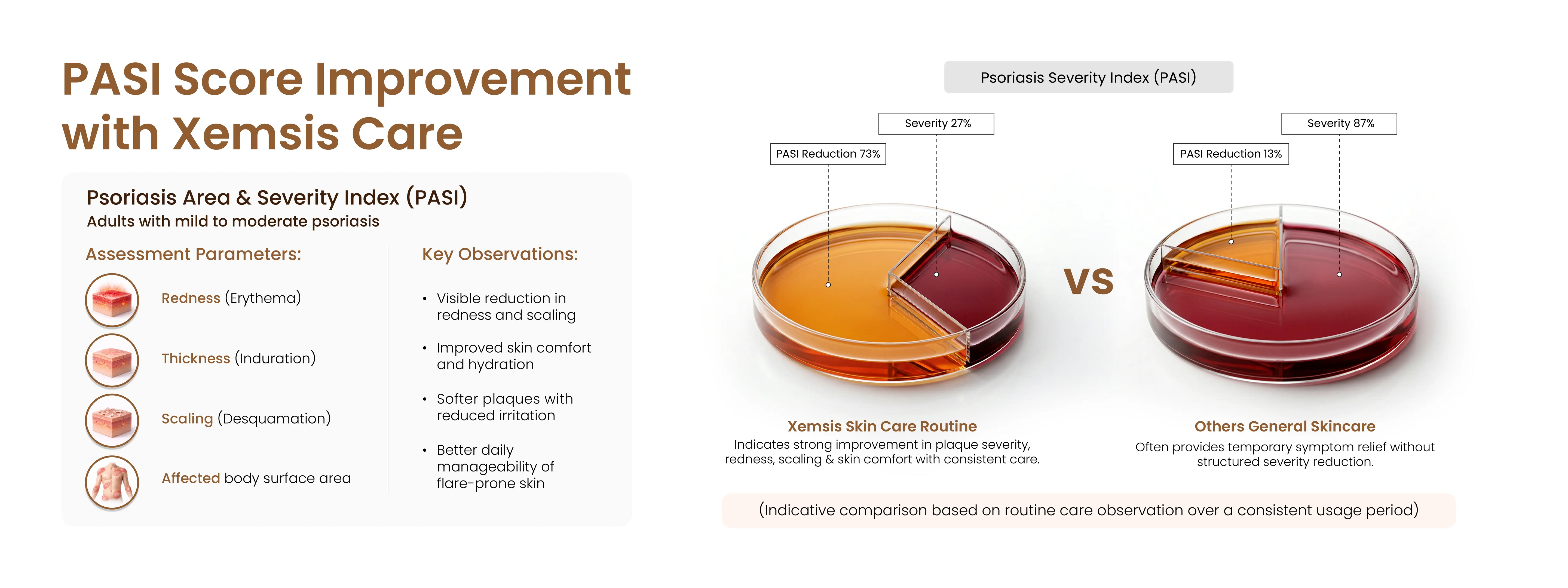 Diagram showing PASI score improvement with Xemsis Care, featuring two pie charts and text.