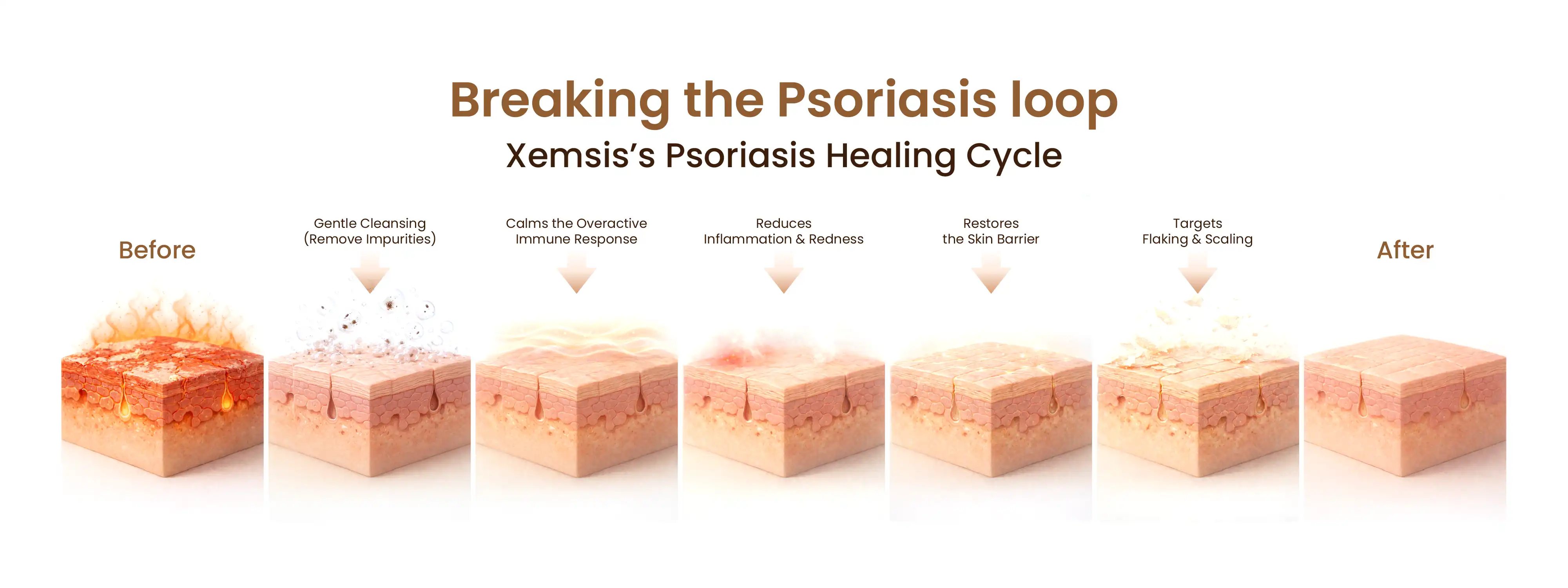 Diagram of Xemsis's Psoriasis Healing Cycle with before and after illustrations.
