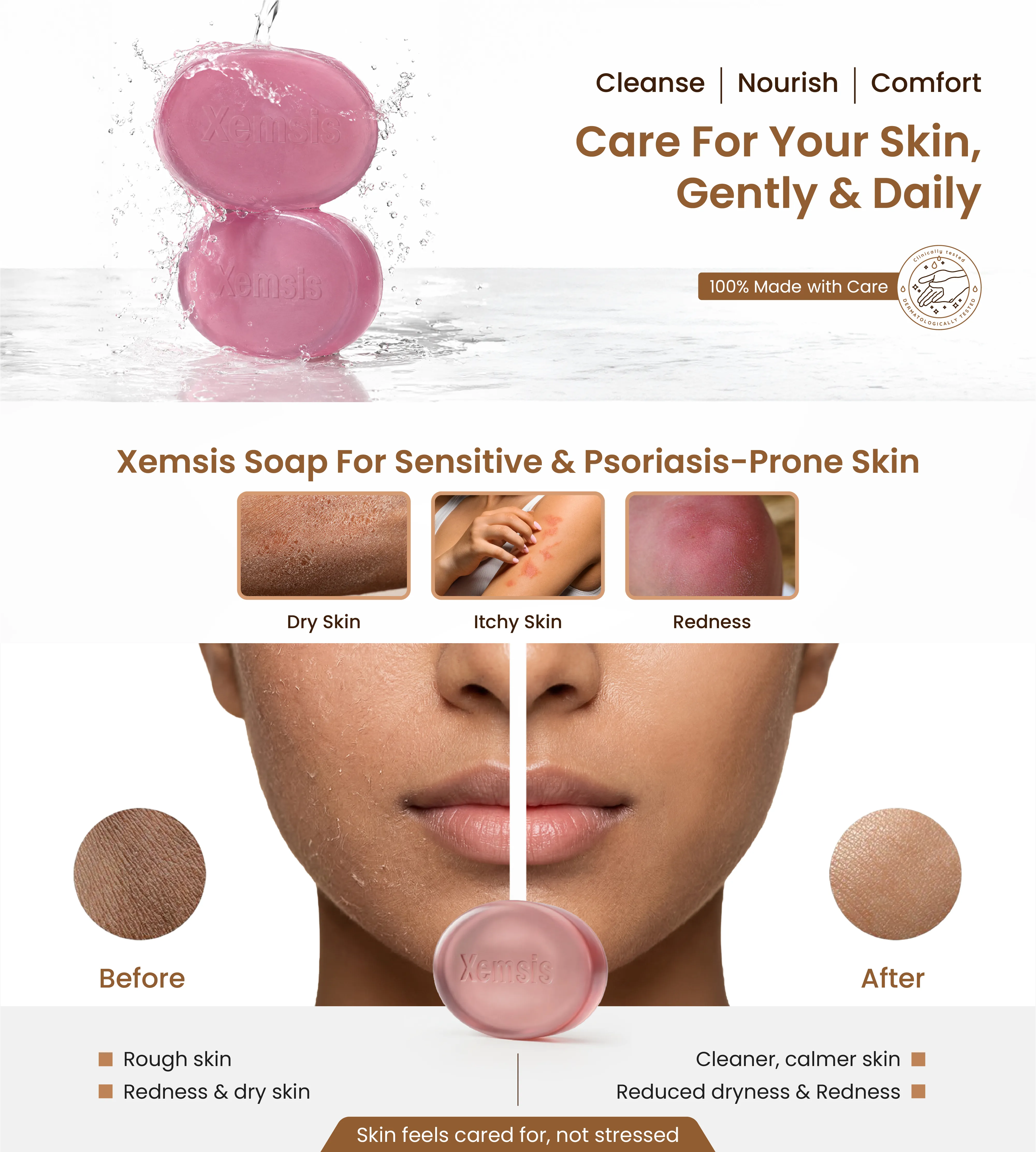 Xemsis soap for sensitive and psoriasis-prone skin with before and after effects on skin.