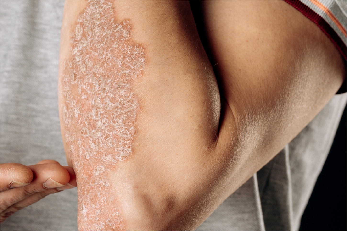 Close-up of a person's arm with a scrub on it, against a neutral background.